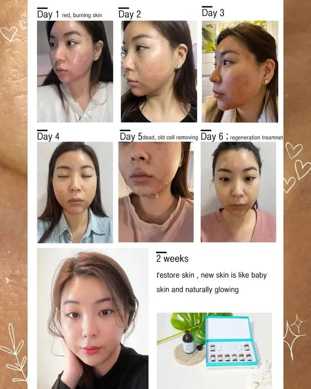 BIO SEACIL Exfola – Peeling coréen aux spicules d’algues et aux acides DM CELL