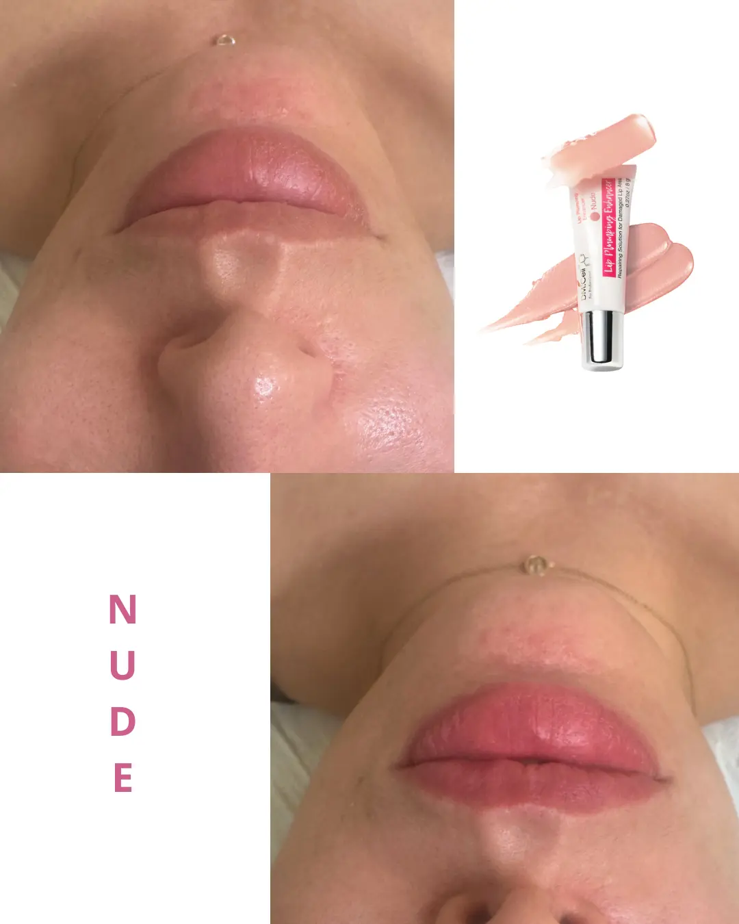 Lip Plumping Enhancer – BB Lips DM CELL