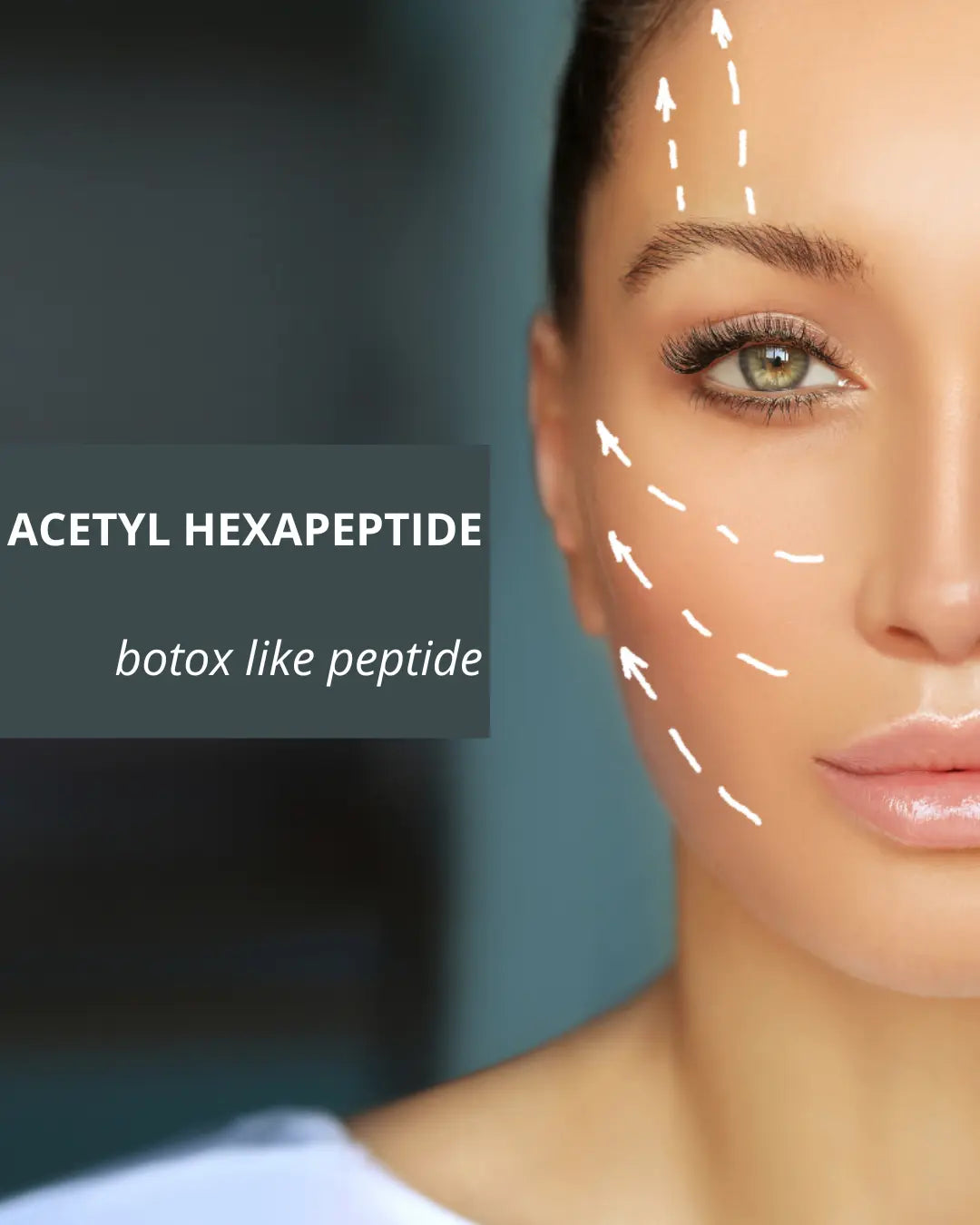 L-alternative-au-botox-par-microneedling-avec-l-actif-botox-like KOREA LABS