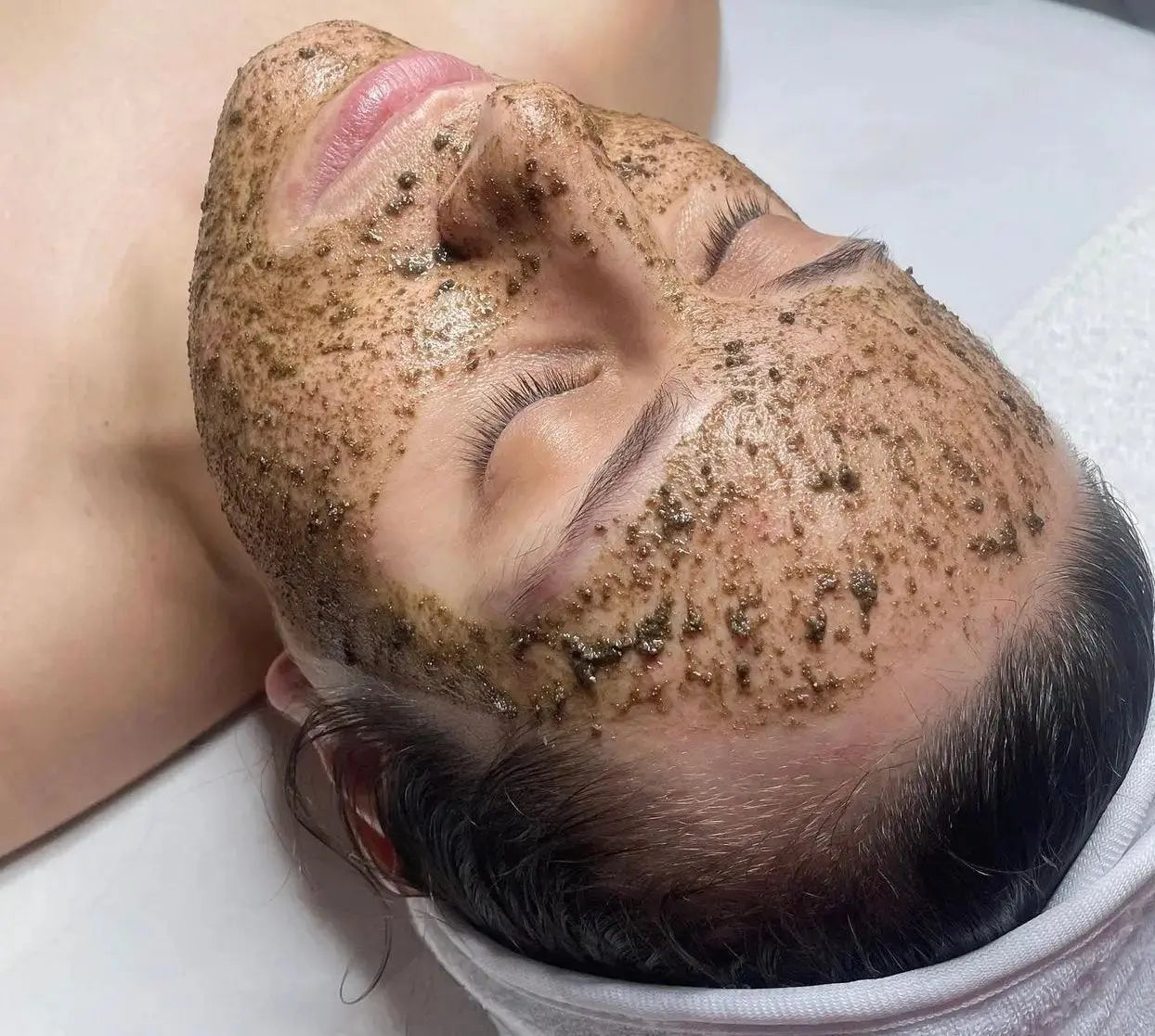 Peeling-aux-algues-vs-Peeling-chimique-comprendre-la-différence-pour-mieux-traiter-la-peau KOREA LABS