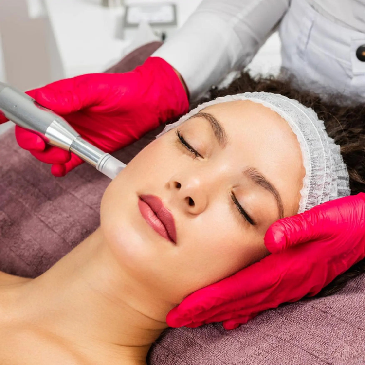 femme microneedling