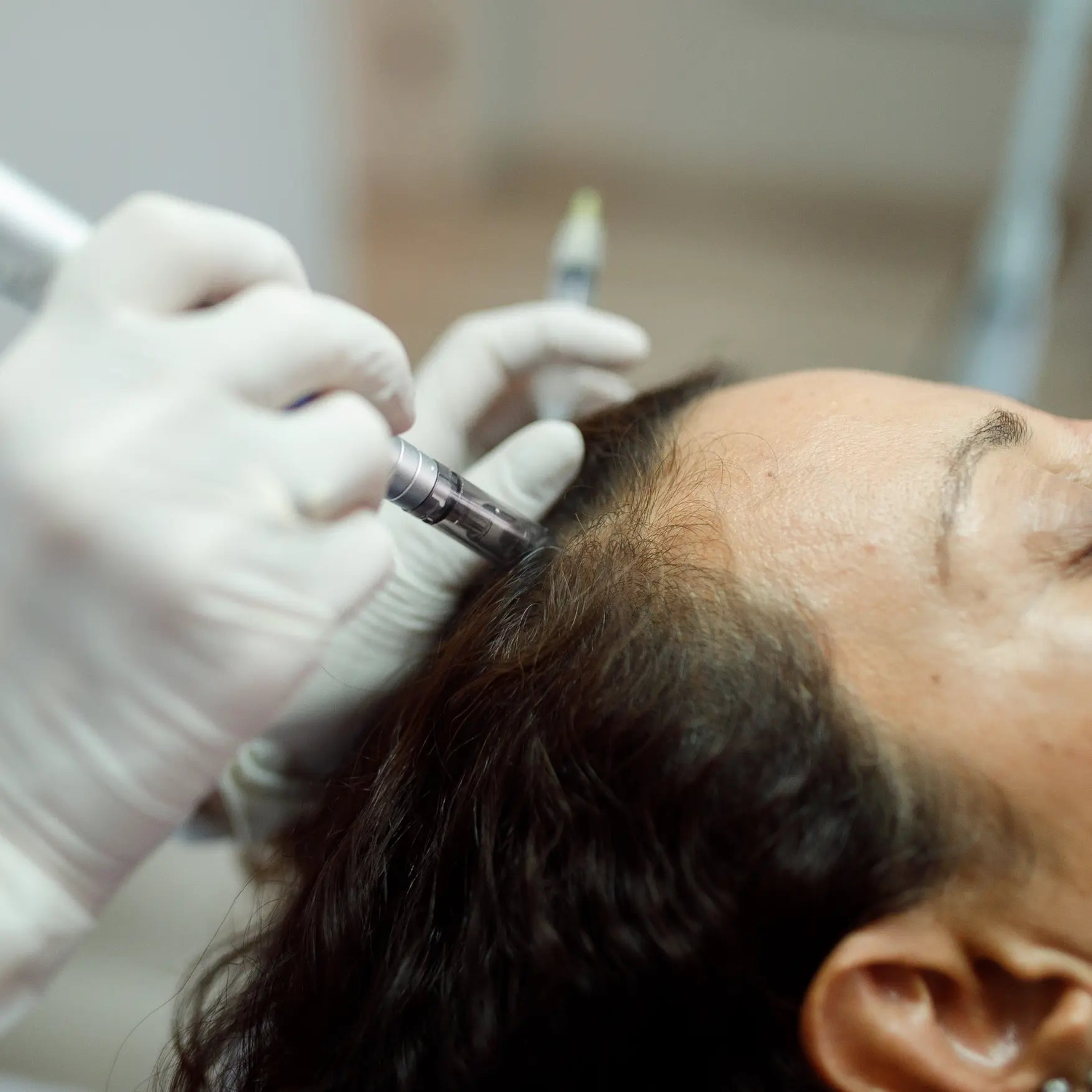 traitement hairneedling
