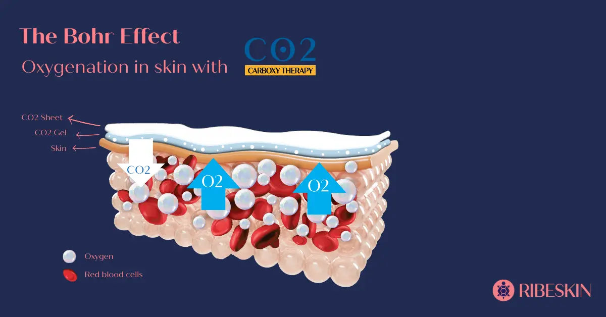 CO2 CARBOXY THERAPY SET RIBESKIN