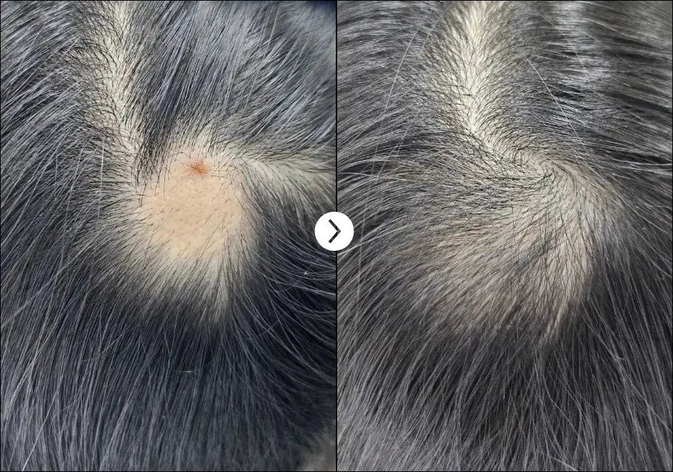 HAIRLOPECIA MESO COMPLEX RIBESKIN