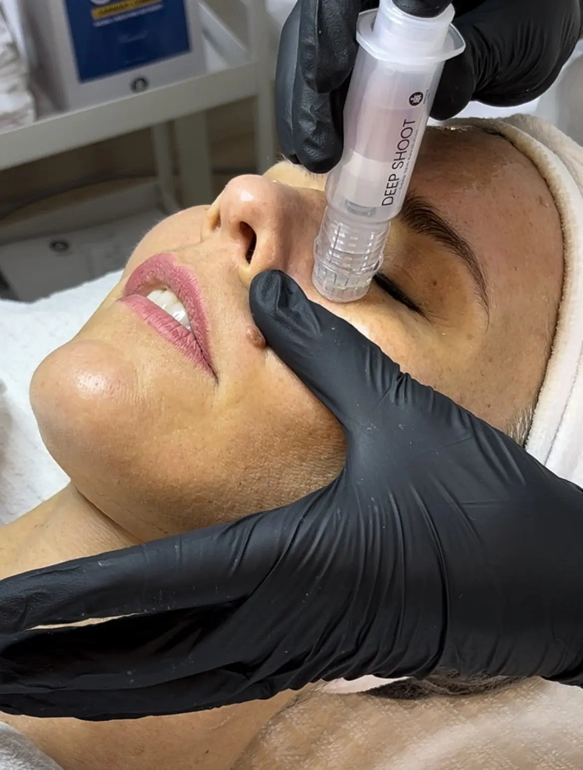 DEEP SHOOT AA de RIBESKIN RIBESKIN
