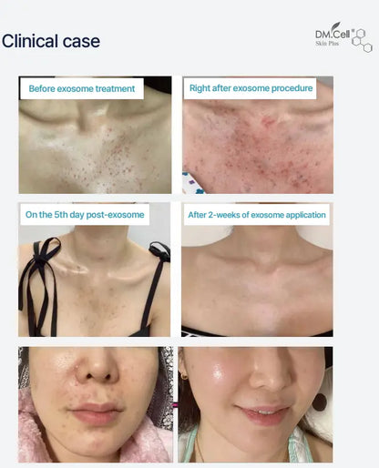 EXOSOME BOOSTER DM CELL