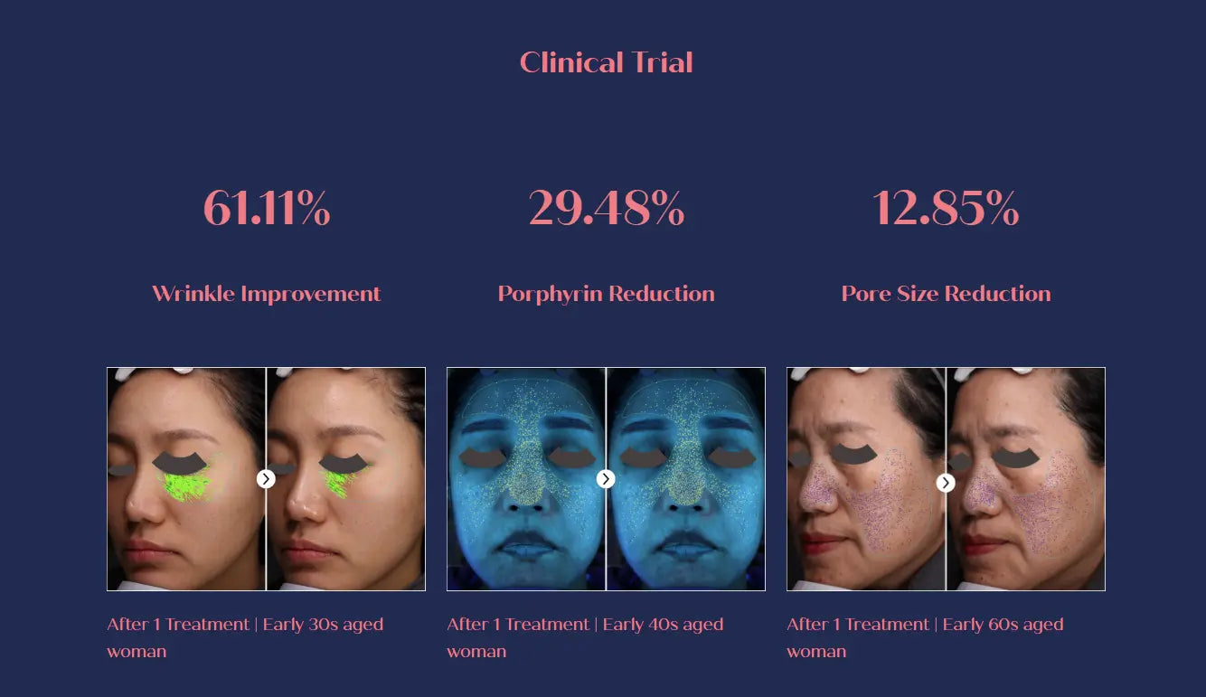 CO2 CARBOXY THERAPY RIBESKIN