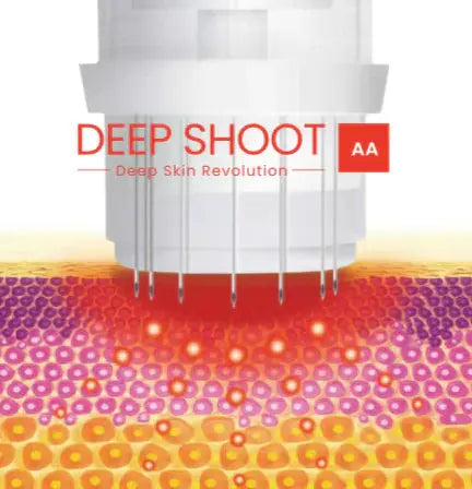 DEEP SHOOT AA de RIBESKIN RIBESKIN