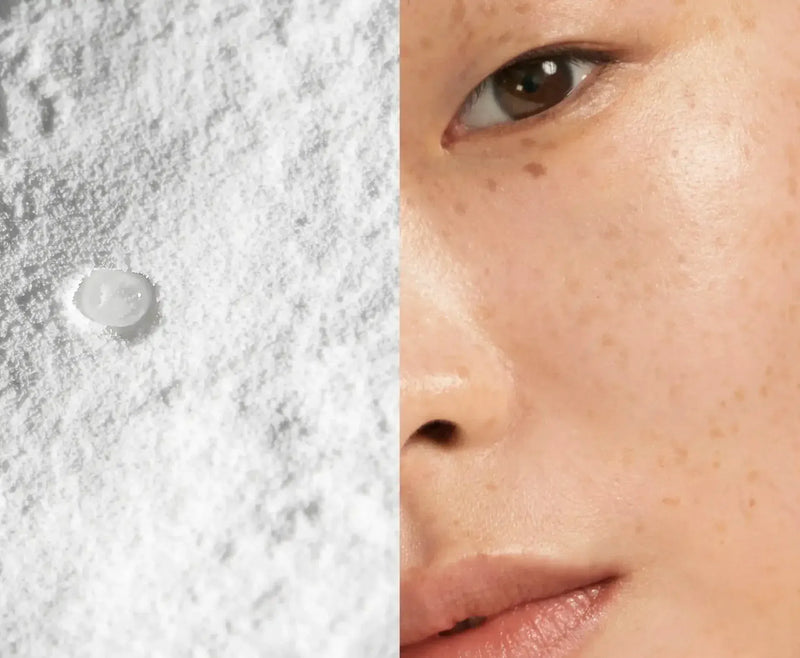 Acné & Imperfections