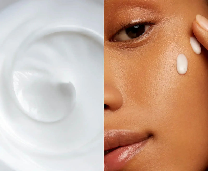 Taches & Hyperpigmentation